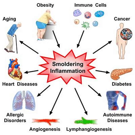 Nutrition-Related Indices and Systemic Inflammation in Acute ... - MDPI - muktibox.com