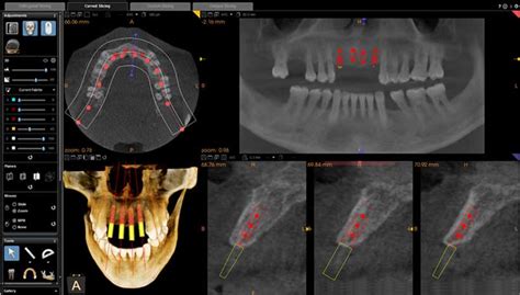 NY Dental CT Scans - Affordable Dental CT Scans. Midtown …