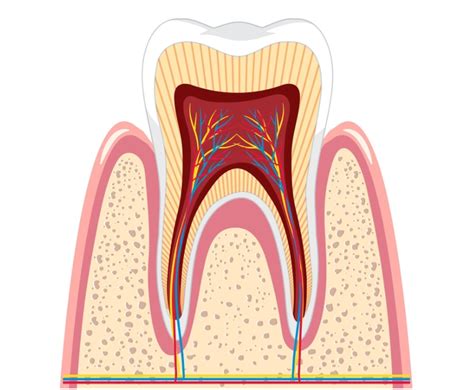 Nackdelar med rotfyllning