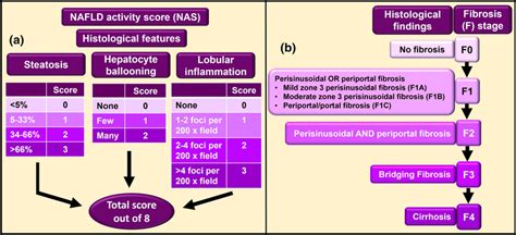 Nafld activity score interpretation.  NAFLD Fibrosis Score NAFLD Fibrosis Score is a no...