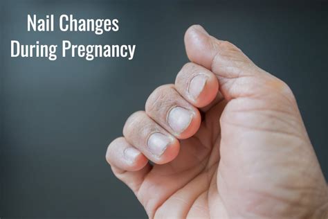 Nail Changes in Pregnancy - Symptoms And Remedies