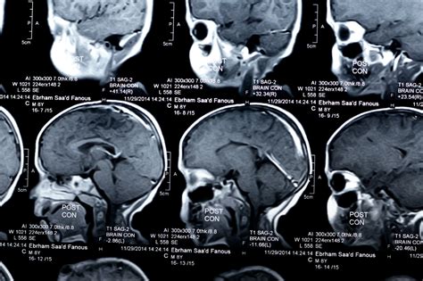 Najbolji neurokirurg na rebru. .  <a href=https://lake-curator-alpha.nexlabs.co.uk/b...