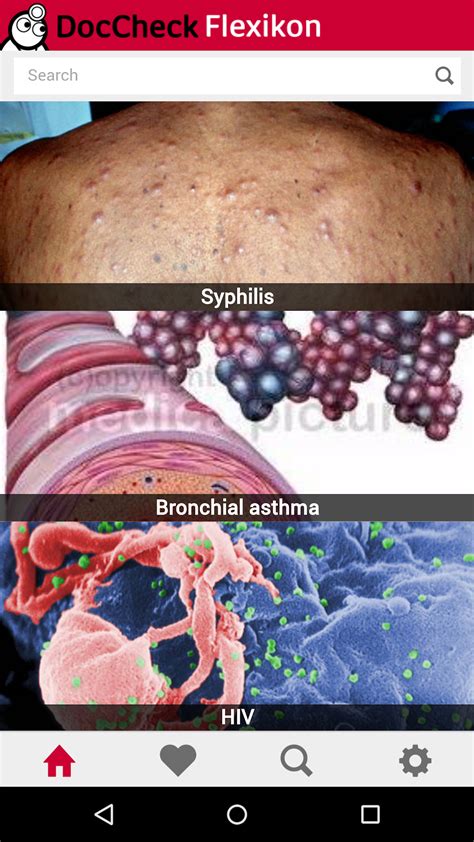 Napsin A DocCheck Flexikon. 