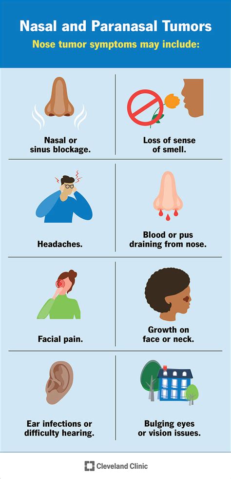 Nasal and paranasal tumors - Symptom…