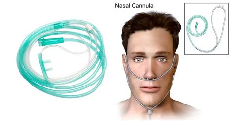 Benefits and use of the nasal oxygen cannula in medical treatments