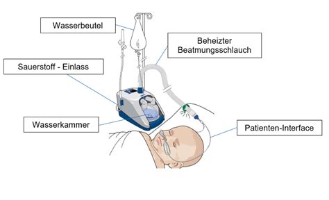 Nasale High-flow-Sauerstofftherapie Request PDF - ResearchGate