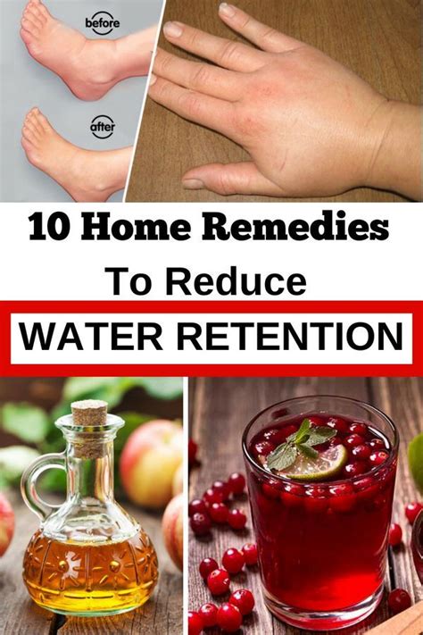 Natural Home Remedies for Water Retention