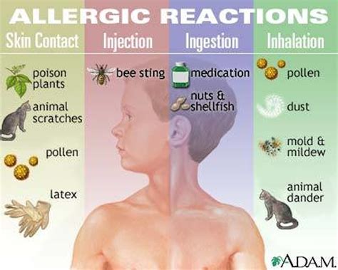 Nectar allergy. Things To Know About Nectar allergy. 