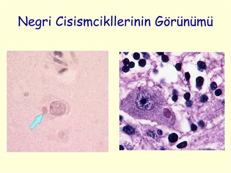Negri cisimcikleri . 