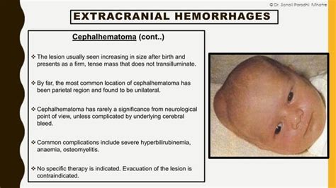 Neonatal Intracranial Hemorrhage - by dr. Sonali Mhatre