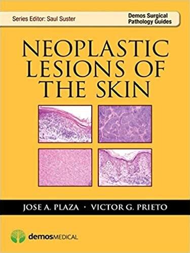 Neoplastic lesions of the skin demos surgical pathology guides. - Morte da porta-estandarte, tati, a garota e outras histórias, a.