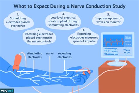Nerve Conduction Test Explained