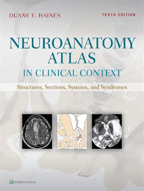 Read Neuroanatomy By Duane E Haines