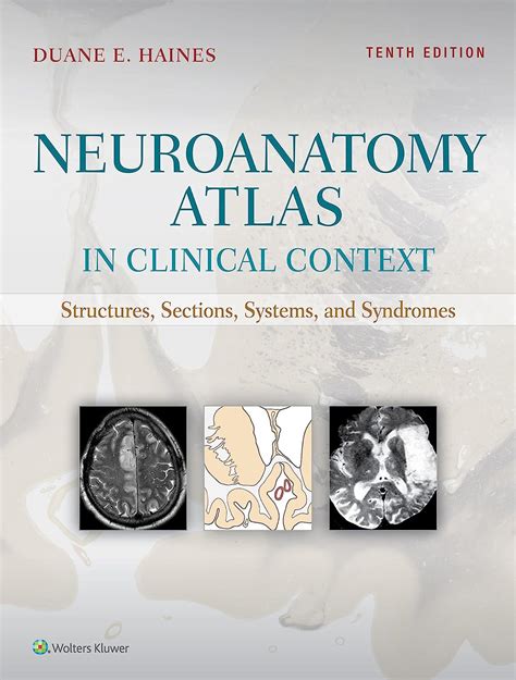Read Neuroanatomy In Clinical Context An Atlas Of Structures Sections Systems And Syndromes By Duane E Haines