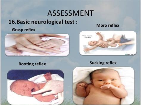 Neurological Assessment of the Neonate, Infant, Child