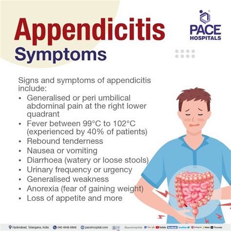 Neuroma of the appendix, a rare cause of appendicitis …