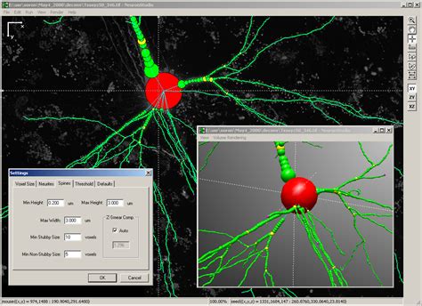 Neuronstudio - LiquiSearch