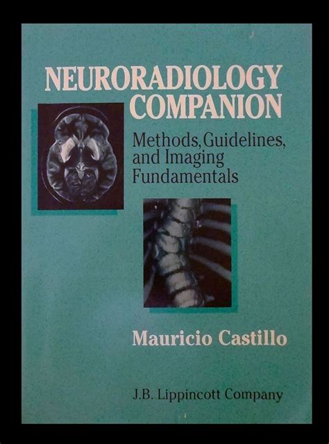 Neuroradiology companion methods guidelines and imaging fundamentals imaging companion series by mauricio castillo md 2011 08 29. - Auf dem strom. ( ab 14 j.)..