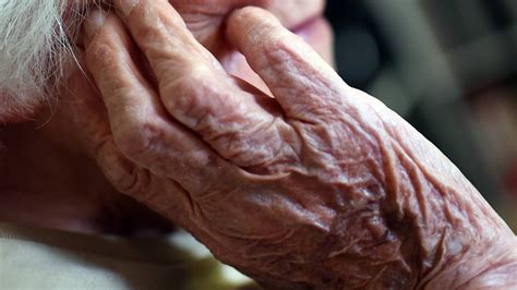 New Alzheimer’s drug is first to show it slows disease. But It’s facing a rocky rollout