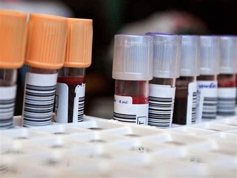 New Blood Test Can Detect Concussions