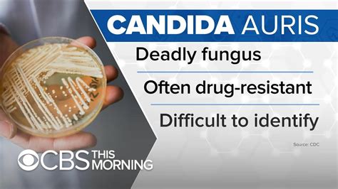 New York moves to prevent drug-resistant Candida auris fungus infections