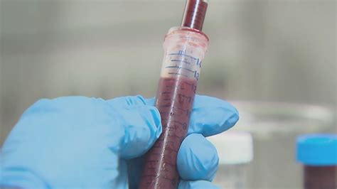 New blood test tells patients if they will experience future heart, kidney problems