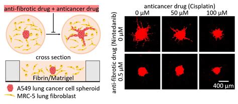 New cancer drug reduces tumor size by