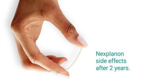 Nexplanon Side effects and what to do about them