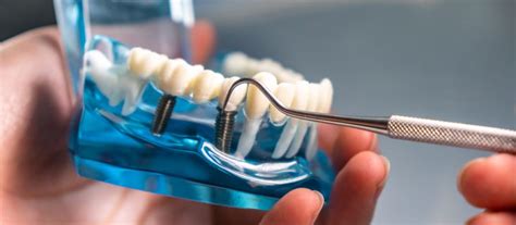 Niagara Dental Implant & Oral Surgery, Williamsville, NY