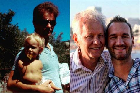 Nick vujicic parents
