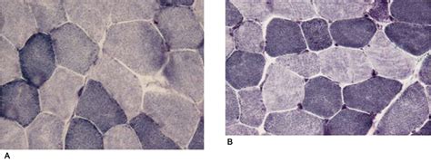 Nicotinamide adenine dinucleotide tetrazolium reductase …