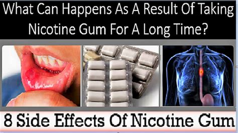 Nicotine Gum Side Effects Teeth: What You Should Know