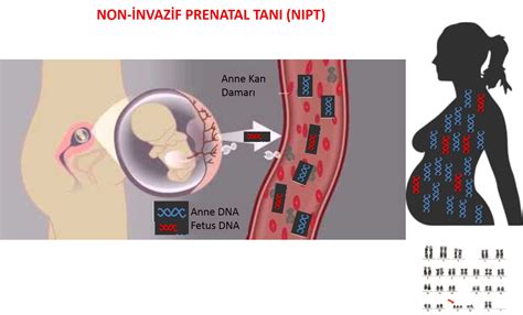 Nipt Testi Antalya Genetik Test Merkezi.