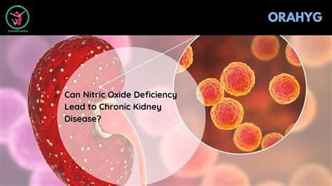 Nitric oxide deficiency in chronic kidney disease - PubMed