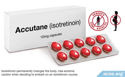th?q=No+prescription+needed+for+isotretinoin