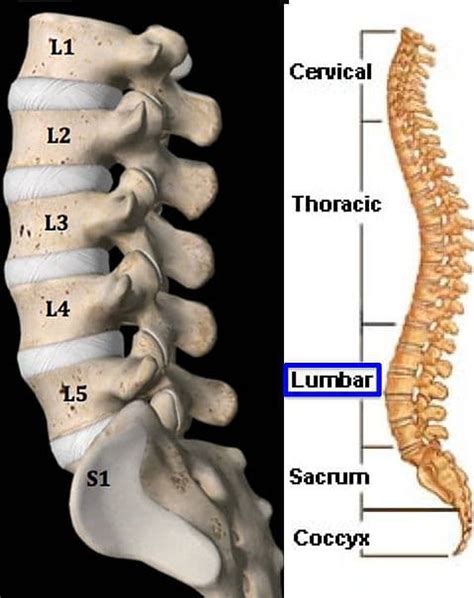 Non Rib Bearing Lumbar Type Vertebral Bodies: A Key Component for Spinal Stability