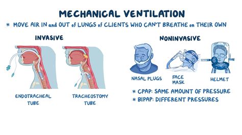 Non-invasive mechanical ventilation Deranged Physiology