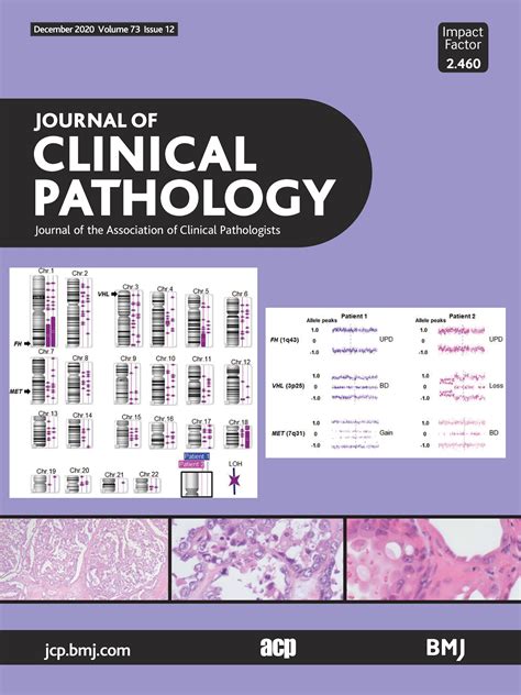 Non-neoplastic colorectal disease biopsies: evaluation and …