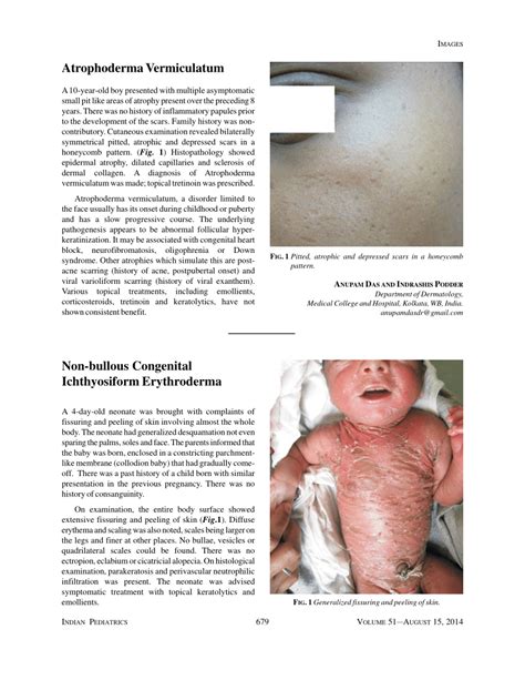 Nonbullous congenital ichthyosiform erythroderma - MedlinePl…