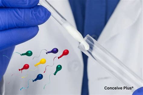 Normal Sperm Color Char