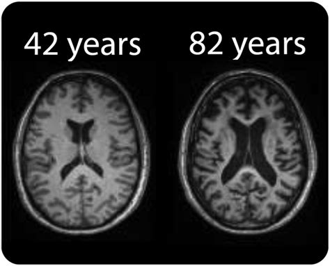 th?q=Normal human brain matures at age