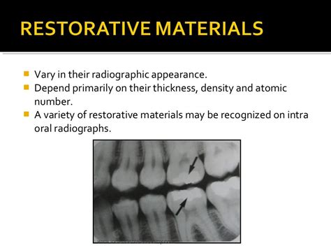 Normal radiographic anatomical landmarks / dental courses