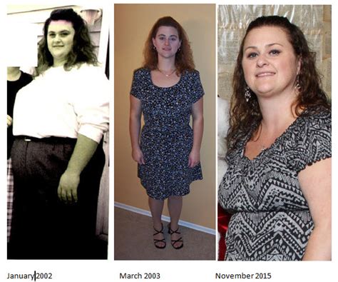 Not feeling restriction - Gastric Bypass Surgery Forums - BariatricPal