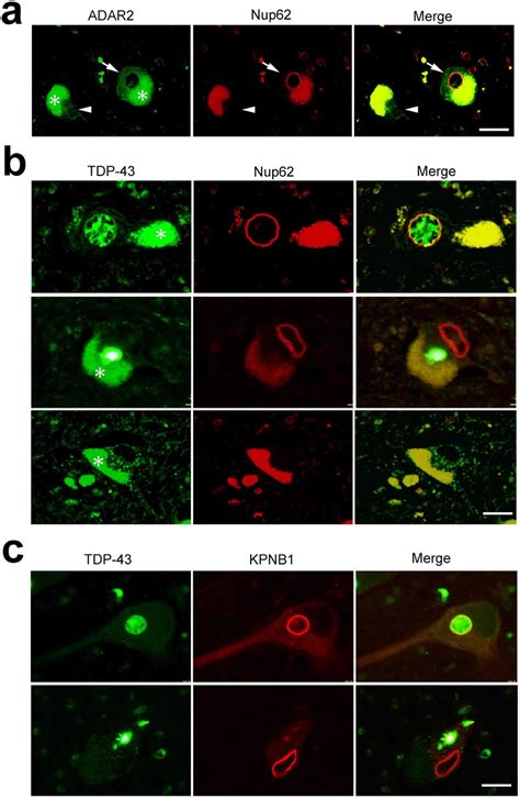 Nucleo–cytoplasmic transport defects and protein aggregates in ...