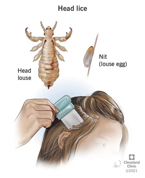 Nude lice