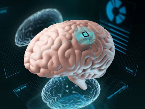 Nuerolink stock. Neuralink IPO. Neuralink is a privately-held brain computer interface (BCI) company. Its mission is to develop a generalized brain interface that can process and transfer neural signals. The Neuralink valuation is $5 billion, up from close to $2 billion in 2021. Non-accredited investors cannot buy Neuralink stock yet on the NYSE or NASDAQ stock ... 