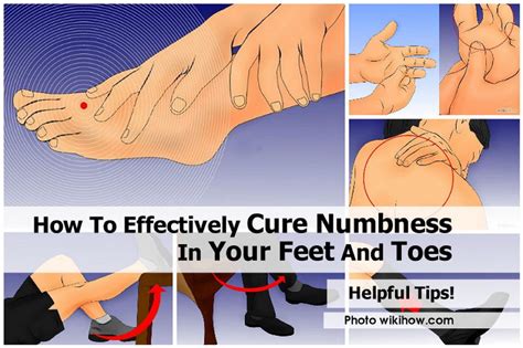 Numbness in feet when standing