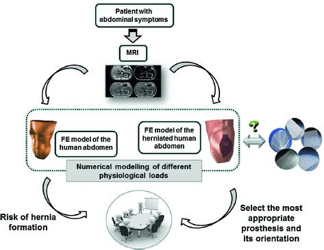 Numerical Modelling Help Surgeons in Abdominal Hernia …