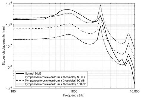 Numerical Study of Tympanosclerosis Including Its Effect on Human Hearing