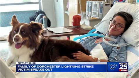 Nurse struck by lightning while walking dog in Dorchester continuing road to recovery